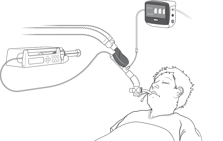 Set Up Schematic